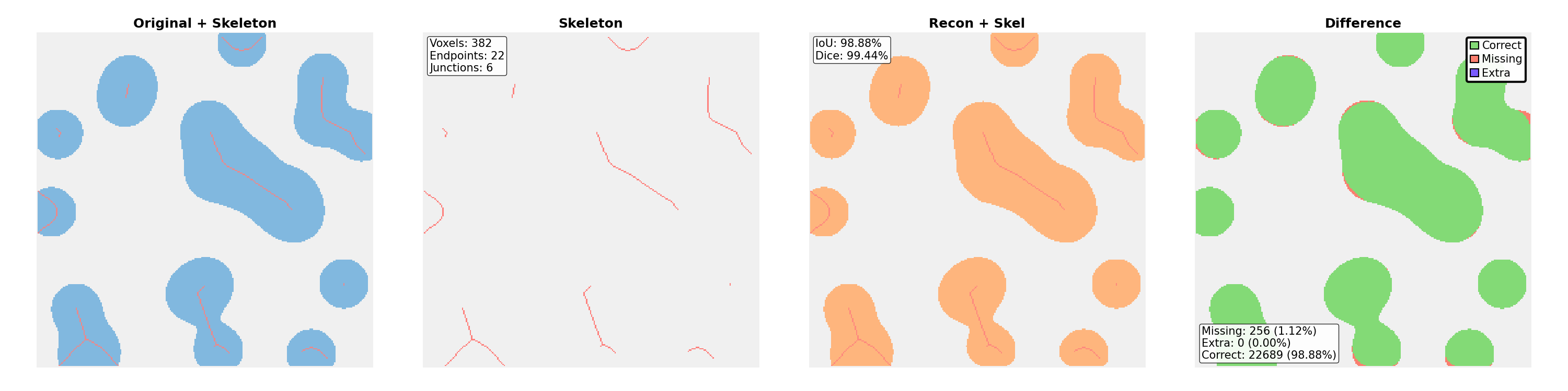 MA (medial axis): skeletonization result